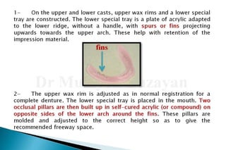 Flat ridge management
