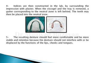 Flat ridge management