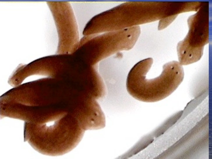 flatworms