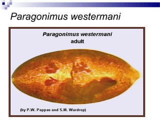 Paragonimus westermani
 
