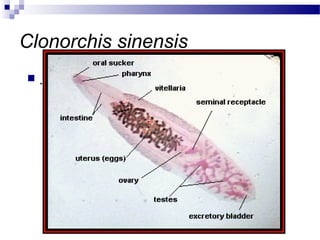 Clonorchis sinensis
 .
 