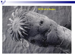 SEM of a Scolex
 