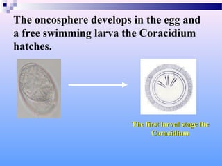 The oncosphere develops in the egg and
a free swimming larva the Coracidium
hatches.
The first larval stage the
The first larval stage the
Coracidium
Coracidium
 