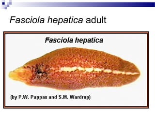 Fasciola hepatica adult
 