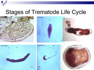 Stages of Trematode Life Cycle
 .
 