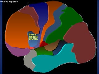 Humberto Crivellari Palavra repetida Broca articula BRASIL 