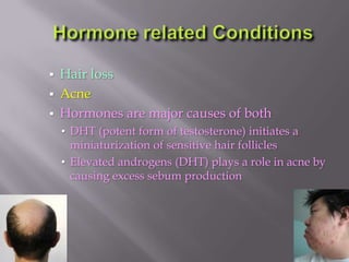  Hair loss
 Acne
 Hormones are major causes of both
• DHT (potent form of testosterone) initiates a
miniaturization of sensitive hair follicles
• Elevated androgens (DHT) plays a role in acne by
causing excess sebum production
 