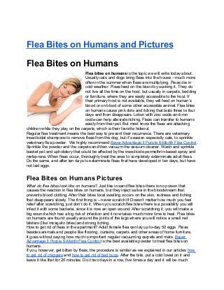 Flea Bites on Humans and Pictures

Flea Bites on Humans
                                  Flea bites on humans is the topic we will write today about.
                                  Usually cats and dogs bring fleas into the house – much more
                                  often in the summer when fleas are multiplying. Fleas die in
                                  cold weather. Fleas feed on the blood by sucking it. They do
                                  not live all the time on the host, but usually in carpets, bedding
                                  or furniture, where they are easily accessible to the host. If
                                  their primary host is not available, they will feed on human’s
                                  blood or on blood of some other accessible animal. Flea bites
                                  on humans cause pink dots and itching that lasts three to four
                                  days and then disappears. Lotion with zinc oxide and iron
                                  oxide can help alleviate itching. Fleas can transfer to humans
                                  easily from their pet. But most know the fleas are attacking
children while they play on the carpets, which is their favorite hideout.
Regular flea treatment means the best way to prevent their recurrence. There are veterinary
insecticidal shampoos to remove fleas from the dog, but it’s easier, especially cats, to sprinkle
veterinary flea powder. We highly recommend Bayer Advantage II Purple 6-Month Flea Control.
Sprinkle the powder and the carpets and then vacuum the vacuum cleaner. Wash and sprinkle
basket pet and upholstery that could be affected by the insecticide permethrin-based spray and
metoprena. When fleas occur, thoroughly treat the area to completely exterminate adult fleas.
Do the same, and after ten days to exterminate fleas that have developed in ten days, but have
not laid eggs.


Flea Bites on Humans Pictures
What do flea bites look like on humans? Just like in sand flea bites there is no poison that
causes the reaction in flea bites on humans, but they inject saliva in the bloodstream that
prevents blood clotting. After their bites local swelling occurs on the skin, redness and itching
that disappears slowly. The first thing is – never scratch it! Doesn’t matter how much you feel
relief after scratching, just don’t do it. When you scratch flea bites there is a possibility you will
infect it with some bacteria, since it is now an open wound. After scratching it, you will make a
big wound which has a big risk of infection and it now takes much more time to heal. Flea bites
on humans are found usually around the joints of the legs where you will notice a small red
blisters (like mosquito bites) and strong itching.
How to get rid of fleas in the apartment? Adult female flea can lay up to-day 50 eggs. Fleas
besides animals and people like flooring, curtains, carpets and other areas of home furniture.
It goes without saying how much is important regular vacuuming carpets and mats. Bayer
Advantage II Purple 6-Month Flea Control is the best available powder to treat flea bites on
humans.
If you, however, get bitten by fleas, the procedure is similar as we explained in our articles how
to get rid of chiggers and how to get rid of bed bugs. After the bite, put a cold towel on it and
leave it like that for 20 minutes. Do it two days in a row, five times a day and it will be much
 