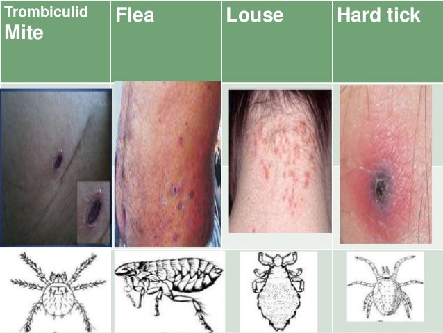 Flea Louse Mites Ticks