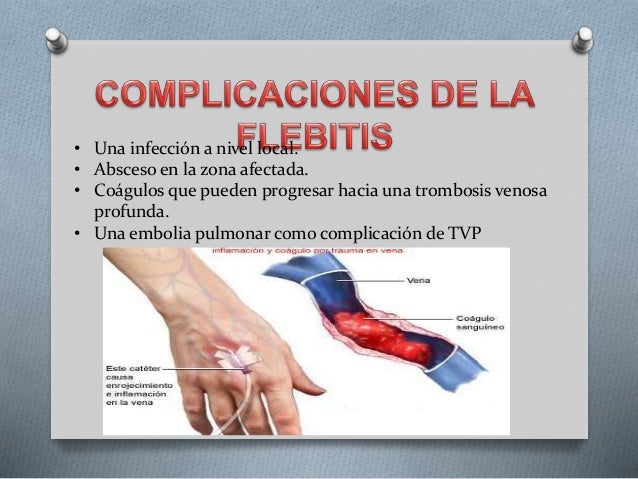Varikoz del labio sexual el parto las revocaciones