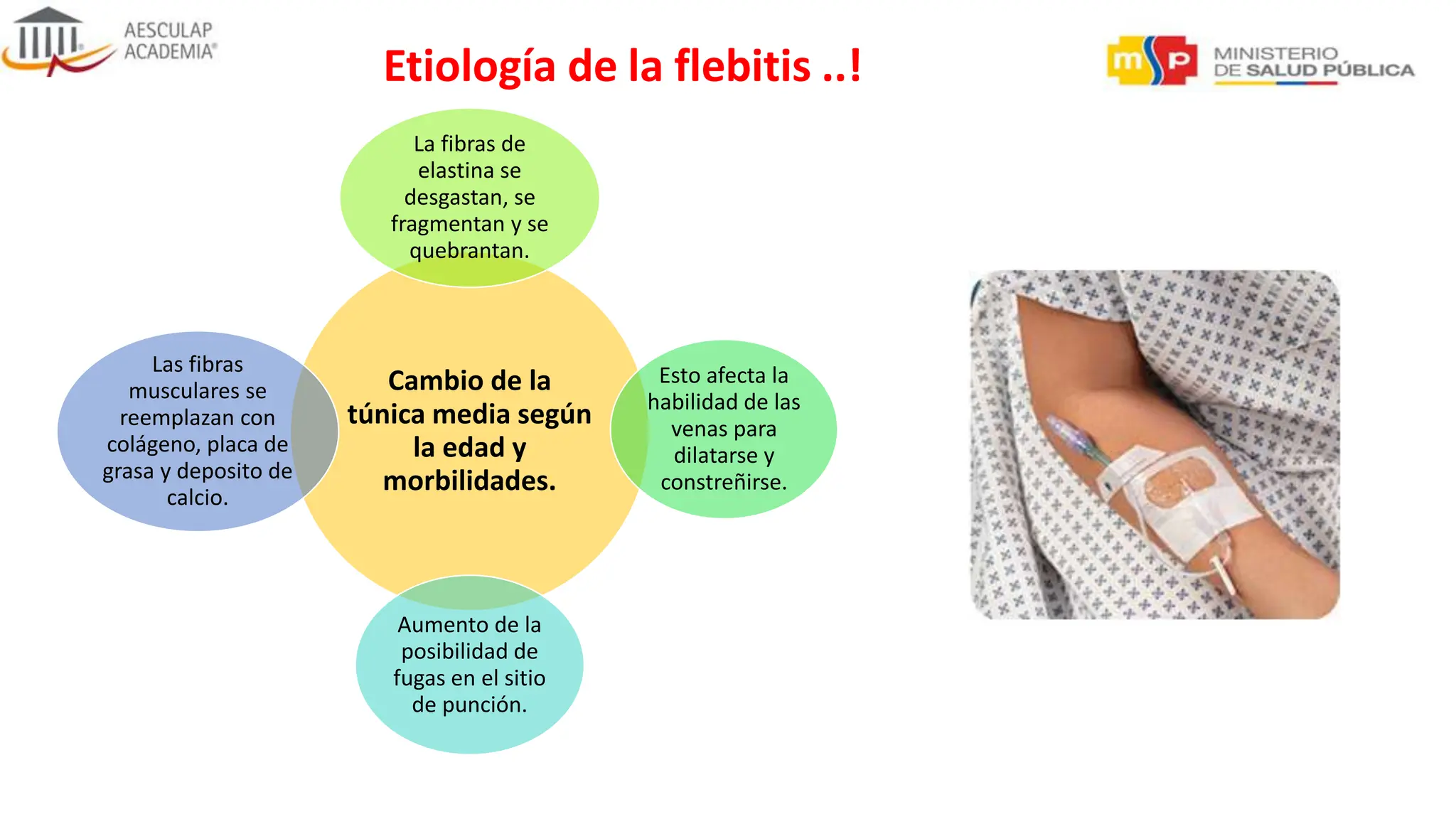 Flebitis QUIMICA, la seguridad en la terapia de infusion HOSPITAL Monte ...