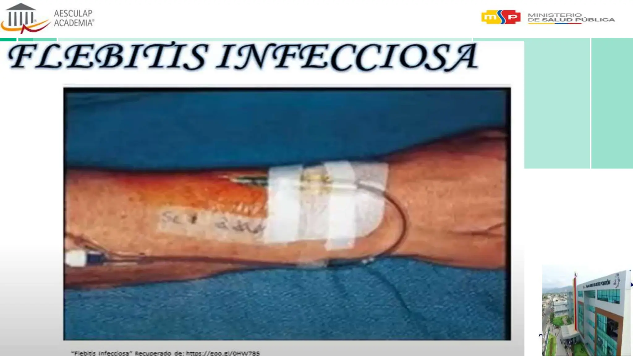 Flebitis QUIMICA, la seguridad en la terapia de infusion HOSPITAL Monte ...