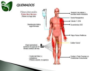 QUEMADOS
 