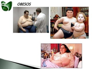 OBESOS
 
