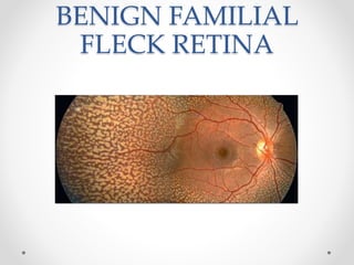Flecks Rettine Fleck retina dr zeeshan | PPTX