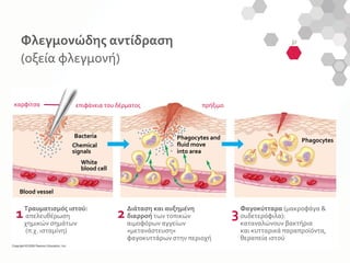 1η
ενότητα. Εννοιολογικοί προσδιορισμοί
White
blood cell
Chemical
signals
Bacteria Phagocytes and
fluid move
into area
Phagocytes
πρήξιμοεπιφάνεια του δέρματος
Φαγοκύτταρα (μακροφάγα &
ουδετερόφιλα):
καταναλώνουν βακτήρια
και κυτταρικά παραπροϊόντα,
θεραπεία ιστού
Διάταση και αυξημένη
διαρροή των τοπικών
αιμοφόρων αγγείων
«μετανάστευση»
φαγοκυττάρων στην περιοχή
Τραυματισμός ιστού:
απελευθέρωση
χημικών σημάτων
(π.χ. ισταμίνη)
Blood vessel
21 3
καρφίτσα
Φλεγμονώδης αντίδραση
(οξεία φλεγμονή)
 