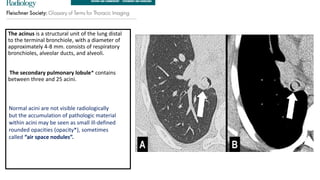 Normal Acinus Comprehensive Radiological Insights into Pulmonary Anatomy and ...