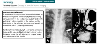 Comprehensive Radiological Insights into Pulmonary Anatomy and ...