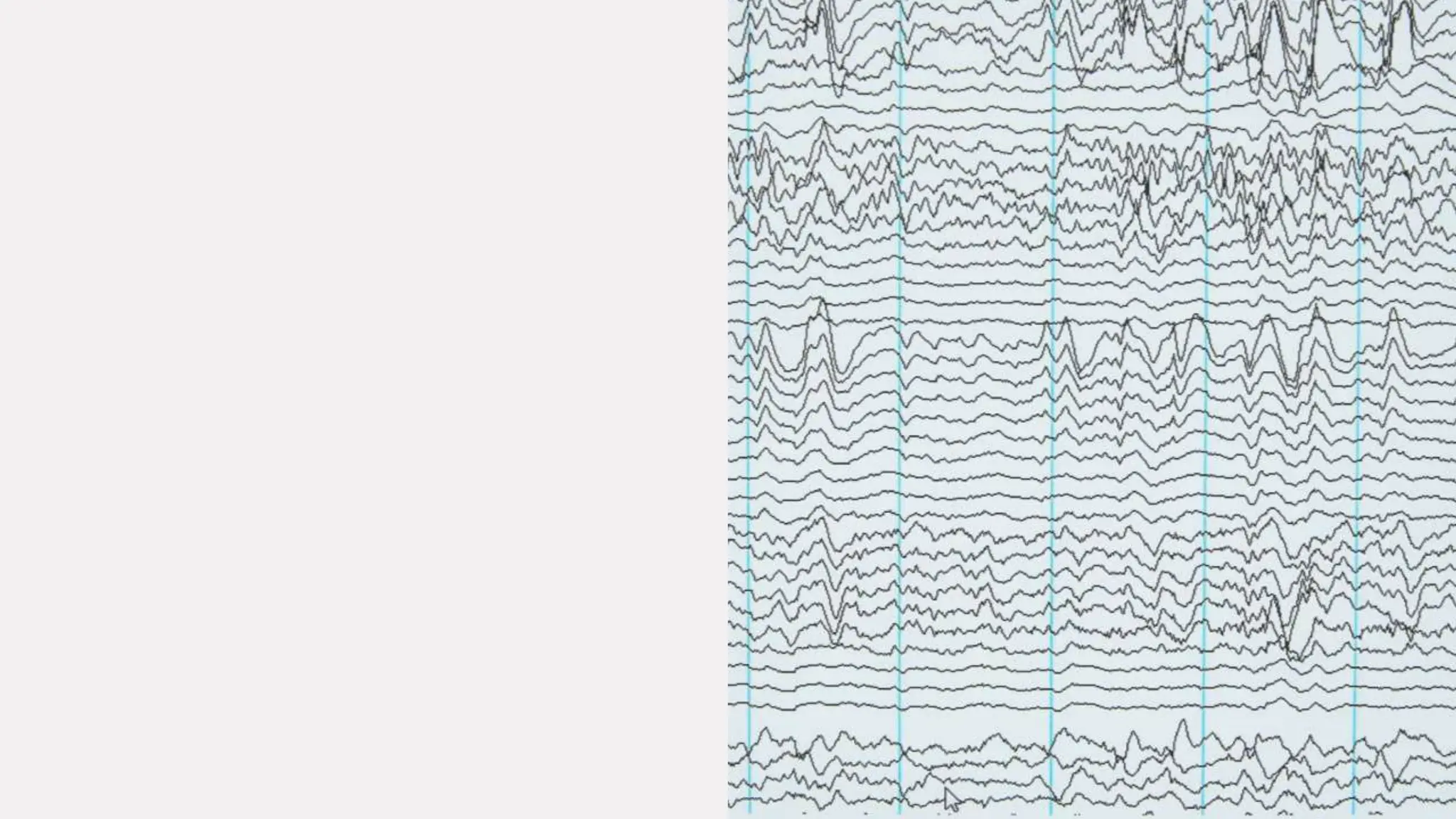 Algorithm of
FlexFind
• With the ranking levels in the
previous slide, FlexFind
priorities ranking in
descending order of a derived
value which is calculated as
• (domain autority + number of
backlinks +(1.5*page
optimization score))/3
 