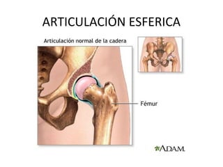 ARTICULACIÓN ESFERICA
 