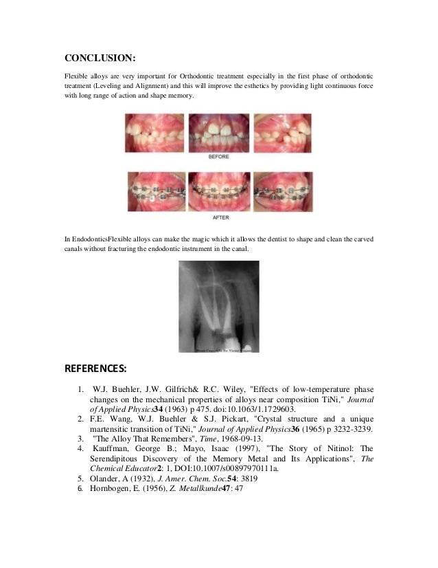 wire orthodontics coaxial alloy endodontics used orthodontics Flexible and in