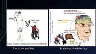 Electronic patches Brain-machine interface
 