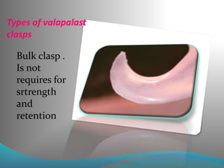 Types of valapalast
clasps
Bulk clasp .
Is not
requires for
srtrength
and
retention
 