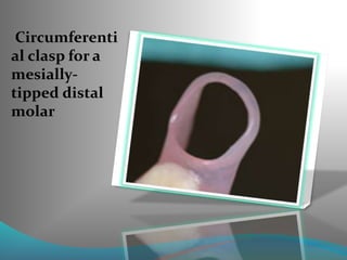 Circumferenti
al clasp for a
mesially-
tipped distal
molar
 