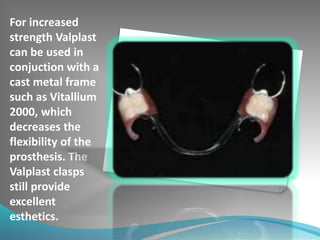 For increased
strength Valplast
can be used in
conjuction with a
cast metal frame
such as Vitallium
2000, which
decreases the
flexibility of the
prosthesis. The
Valplast clasps
still provide
excellent
esthetics.
 