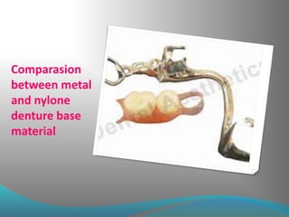 Comparasion
between metal
and nylone
denture base
material
 