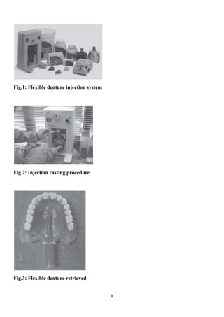 8
Fig.1: Flexible denture injection system
Fig.2: Injection casting procedure
Fig.3: Flexible denture retrieved
 