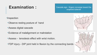 Comprehensive Guide to Flexor and Extensor Tendon Injuries: Anatomy ...