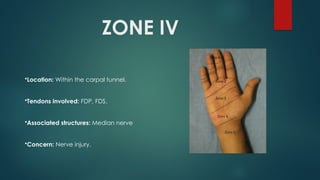 Fds Injuries Comprehensive Overview of Flexor and Extensor Tendon Injuries of the ...
