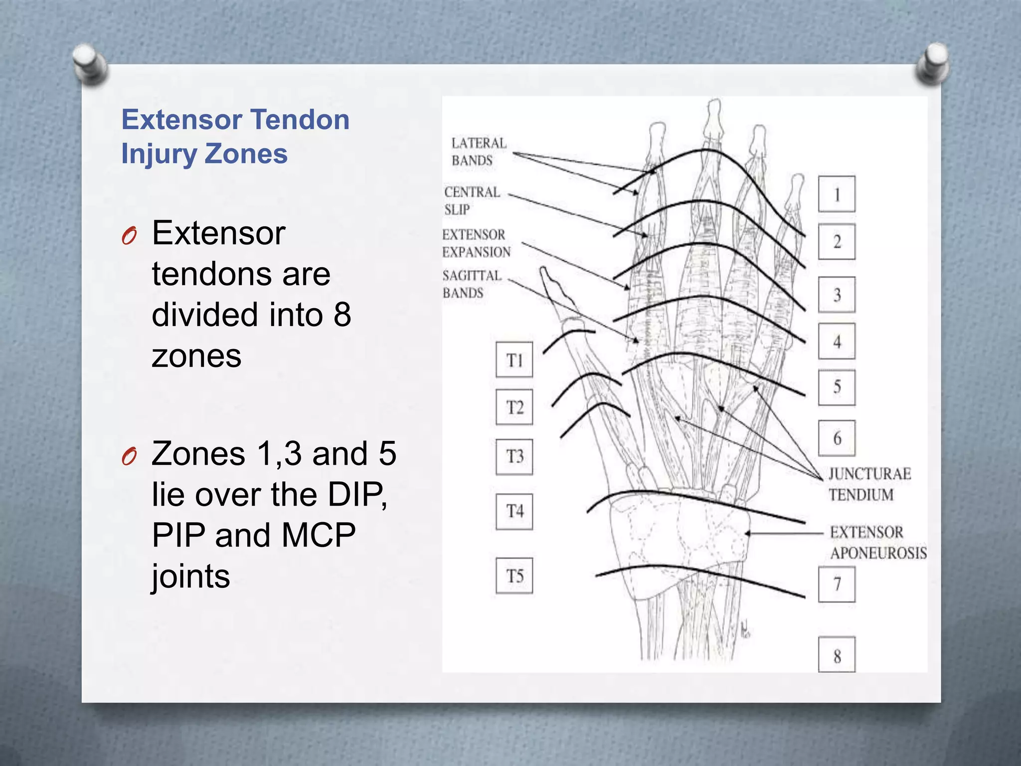 Extensor Tendon
Injury Zones
O Extensor
tendons are
divided into 8
zones
O Zones 1,3 and 5
lie over the DIP,
PIP and MCP
joints
 