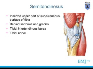 MOB TCD

Semitendinosus
• Inserted upper part of subcutaneous
surface of tibia
• Behind sartorius and gracilis
• Tibial intertendinous bursa
• Tibial nerve

 