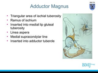 MOB TCD

Adductor Magnus
• Triangular area of ischial tuberosity
• Ramus of ischium
• Inserted into medial lip gluteal
tuberosity
• Linea aspera
• Medial supracondylar line
• Inserted into adductor tubercle

 