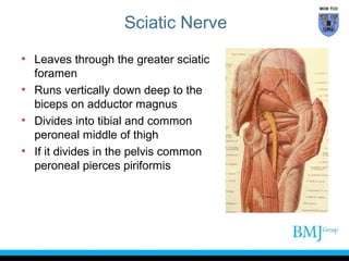 MOB TCD

Sciatic Nerve
• Leaves through the greater sciatic
foramen
• Runs vertically down deep to the
biceps on adductor magnus
• Divides into tibial and common
peroneal middle of thigh
• If it divides in the pelvis common
peroneal pierces piriformis

 