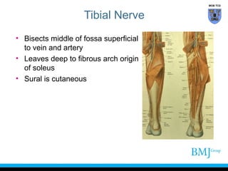 MOB TCD

Tibial Nerve
• Bisects middle of fossa superficial
to vein and artery
• Leaves deep to fibrous arch origin
of soleus
• Sural is cutaneous

 