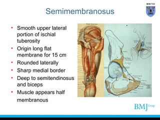 MOB TCD

Semimembranosus
• Smooth upper lateral
portion of ischial
tuberosity
• Origin long flat
membrane for 15 cm
• Rounded laterally
• Sharp medial border
• Deep to semitendinosus
and biceps
• Muscle appears half
membranous

 