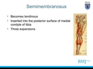 MOB TCD

Semimembranosus
• Becomes tendinous
• Inserted into the posterior surface of medial
condyle of tibia
• Three expansions

 