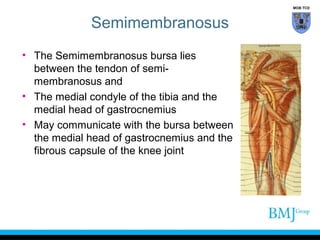 MOB TCD

Semimembranosus
• The Semimembranosus bursa lies
between the tendon of semimembranosus and
• The medial condyle of the tibia and the
medial head of gastrocnemius
• May communicate with the bursa between
the medial head of gastrocnemius and the
fibrous capsule of the knee joint

 