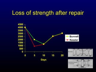 Loss of strength after repair
4500
4000
3500
3000
2500
2000
1500
1000
500
0

Bunnell
Kessler

0

5

10
Days

15

20

 