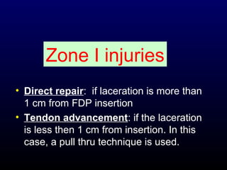 Zone I injuries
• Direct repair: if laceration is more than
1 cm from FDP insertion
• Tendon advancement: if the laceration
is less then 1 cm from insertion. In this
case, a pull thru technique is used.

 
