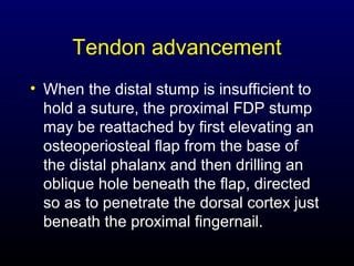 Tendon advancement
• When the distal stump is insufficient to
hold a suture, the proximal FDP stump
may be reattached by first elevating an
osteoperiosteal flap from the base of
the distal phalanx and then drilling an
oblique hole beneath the flap, directed
so as to penetrate the dorsal cortex just
beneath the proximal fingernail.

 