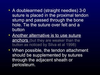 • A doublearmed (straight needles) 3-0
suture is placed in the proximal tendon
stump and passed through the bone
hole. Tie the suture over felt and a
button
• Another alternative is to use suture
anchors (but they are weaker than the
button as noticed by Silva et al 1998)

• When possible, the tendon attachment
should be supplemented by sutures
through the adjacent sheath or
periosteum.

 