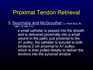 Proximal Tendon Retrieval
3. Sourmelis and McGrouther (J. Hand Surg. Br.
1987; 12:109-111) :

a small catheter is passed into the sheath
and is delivered proximally into a small
wound in the palm, just proximal to the
A1 pulley, the catheter is sutured to both
tendons 2 cm proximal to A1 pulley,
which is then pulled distally to deliver the
tendons into the synovial window

 
