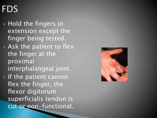  Hold the fingers in
extension except the
finger being tested.
 Ask the patient to flex
the finger at the
proximal
interphalangeal joint.
 If the patient cannot
flex the finger, the
flexor digitorum
superficialis tendon is
cut or non-functional.
 