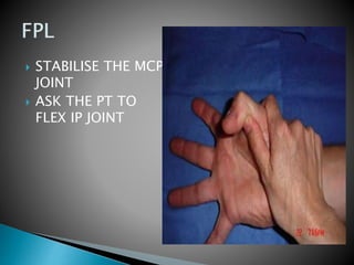 STABILISE THE MCP
JOINT
 ASK THE PT TO
FLEX IP JOINT
 