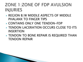  REGION B/W MIDDLE ASPECTS OF MIDDLE
PHALANX TO FINGER TIPS
 CONTAINS ONLY ONE TENDON-FDP
 TENDON LACERATION OCCURS CLOSE TO ITS
INSERTION
 TENDON TO BONE REPAIR IS REQUIRED THAN
TENDON REPAIR
 