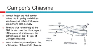 Camper’s Chiasma
 In each finger, the FDS tendon
enters the A1 pulley and divides
into two equal halves that rotate
laterally and then dorsally
 The two slips rejoin deep to the
FDP tendon over the distal aspect
of the proximal phalanx and the
palmar plate of the PIP joint at
Camper's chiasma
 Insert as two separate slips on the
volar aspect of the middle phalanx.
 